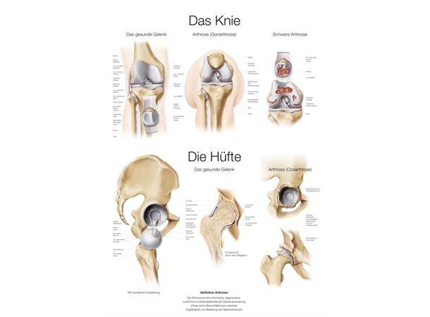 Plakat The Knee & Hip AL551 50 x 70 cm Plast